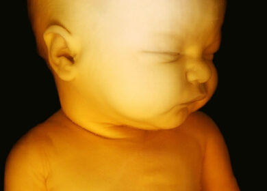 Childhood Obesity Starts in the Womb