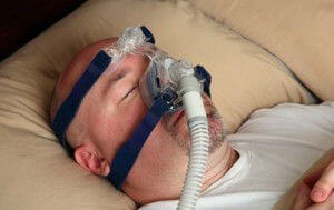 sleep apnea