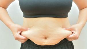 Study: Increase in Abdominal Fat Linked to Higher Risk of Breast Cancer After Menopause