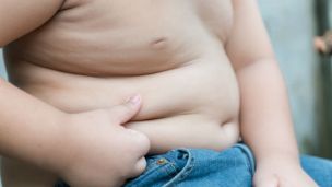 Obese Children Have A Heightened Brain Sensitivity To Sugar