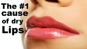 The Secret Causes of Chapped Lips (It’s Not Lip Balm Deficiency!)