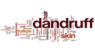 8 Natural Remedies for Itchy Scalp and Dandruff