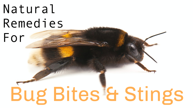 8 Natural DIY Remedies for Summer Bug Bites and Stings