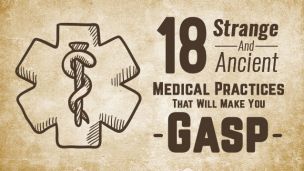 18 Strange And Ancient Medical Practices That Will Make You Gasp