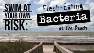 Swim At Your Own Risk: Flesh-Eating Bacteria at the Beach