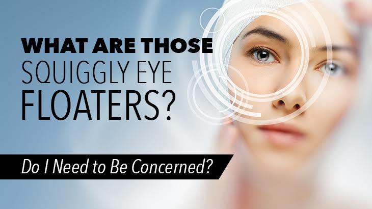 What Are Those Squiggly Eye Floaters? Do I Need to Be Concerned?