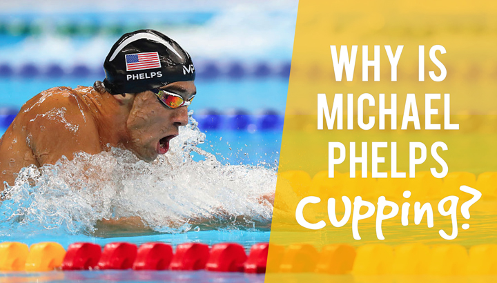 Why Is Michael Phelps Cupping?