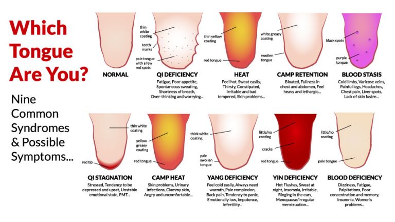 7 Secret Things Your Tongue Is Trying To Tell You