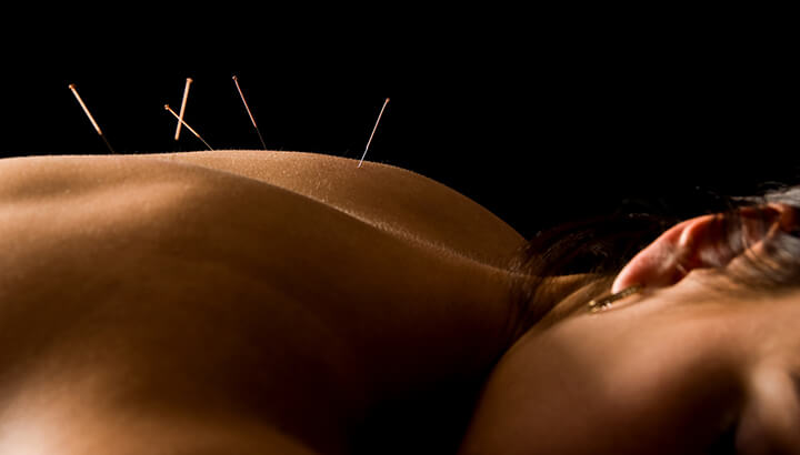 Acupuncture Vs. Morphine: And The Winner Is…