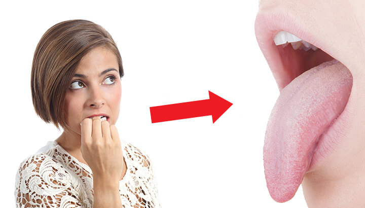 If You Don’t Want Skunk Breath And Herpes, Stop Biting Your Nails