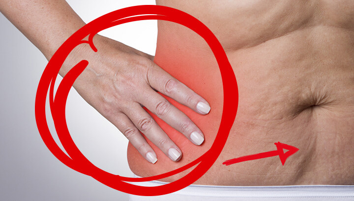 Study Says Inflammation Is Keeping You Fat