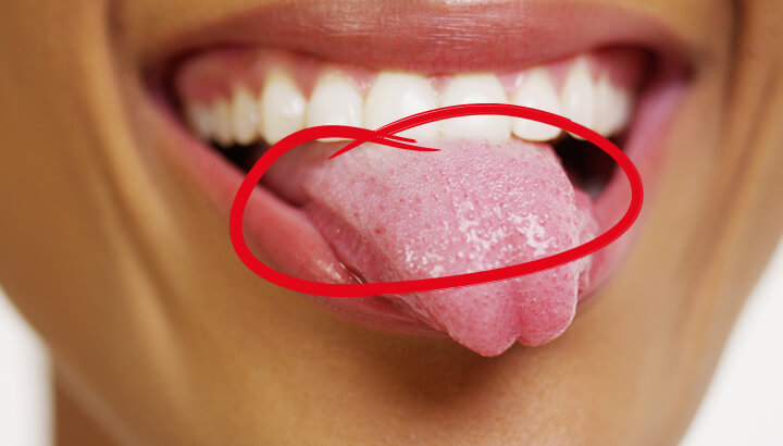 What Your Tongue Scum Is Trying To Tell You