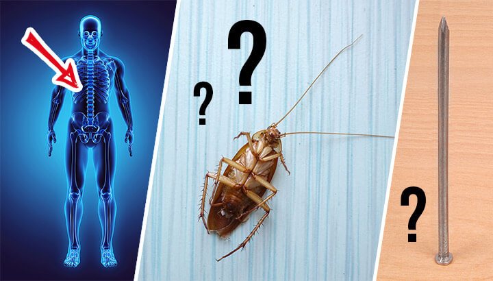 5 Weird Things Doctors Have Found In People’s Bodies