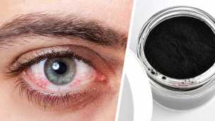 How To Use Activated Charcoal For Pink Eye