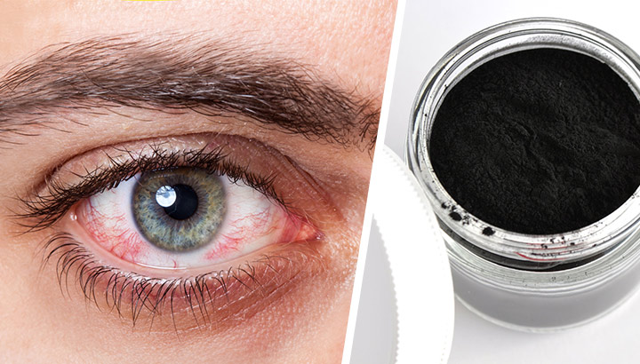 How To Use Activated Charcoal For Pink Eye