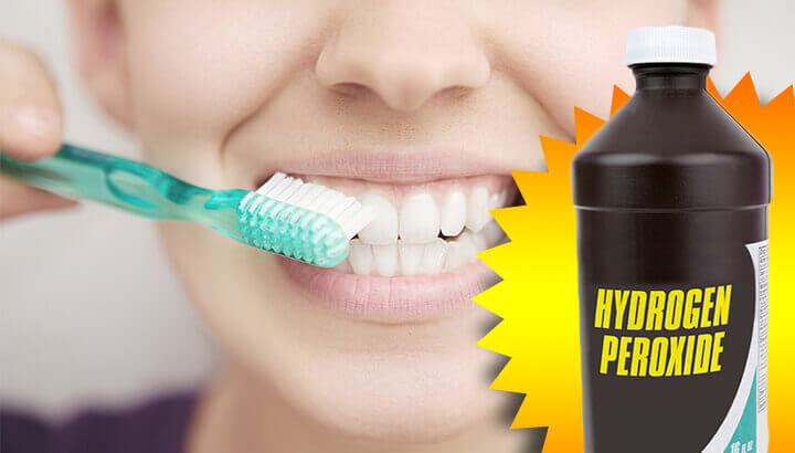 Hydrogen Peroxide For Teeth Whitening, Hair And More