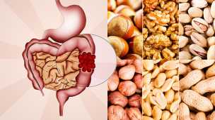 Scientists Say This Food May Help Colon Cancer