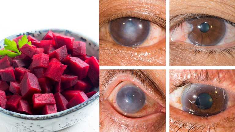 Juice These 3 Superfoods To Detoxify Your Liver And Improve Vision