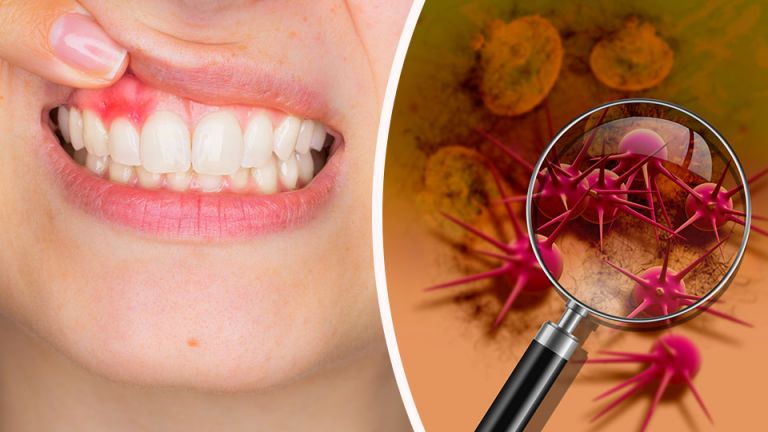 Here’s How To Know If You Have Inflammation In Your Mouth