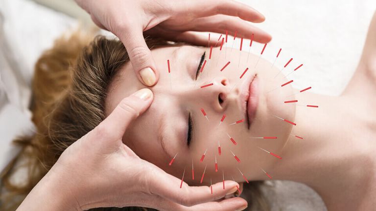 Can Acupuncture Really Mend A Broken Heart Faster?