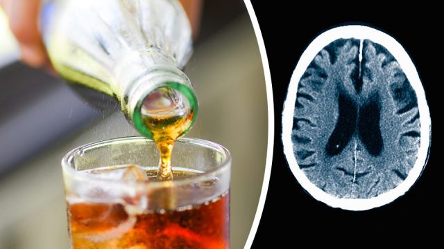 sugardevelopingalzheimersdisease_featured_960x540