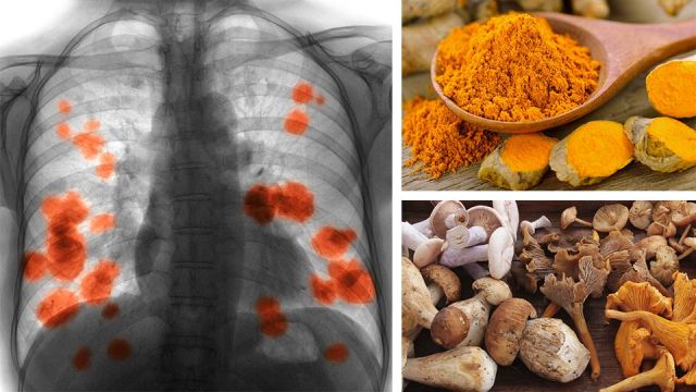 these5foodscanhelpstopthespreadoflungcancer_featured_960x540