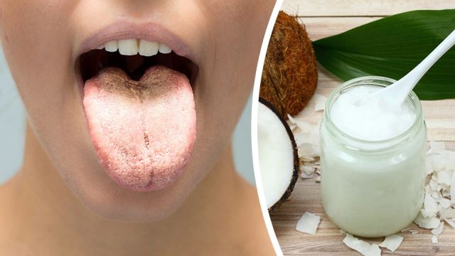 waystocureowncandida_featured_960x540