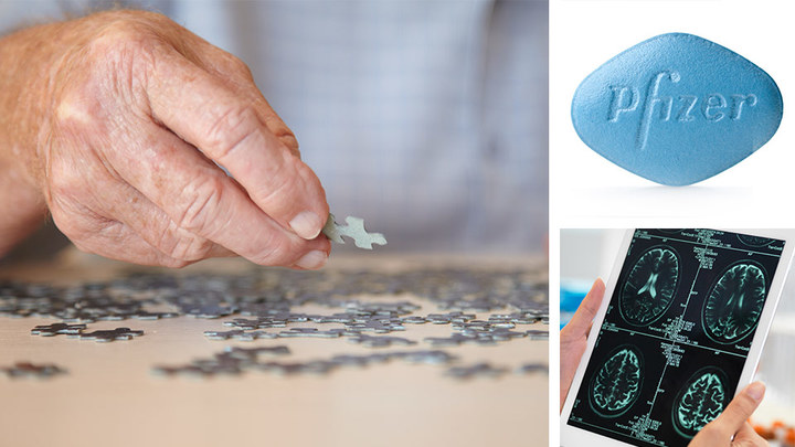 Pfizer Just Pulled The Plug On Dementia Research. Here’s How It Impacts You