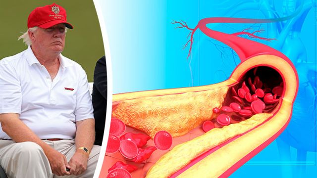 doestrumphaveheartdisease_845x439_39