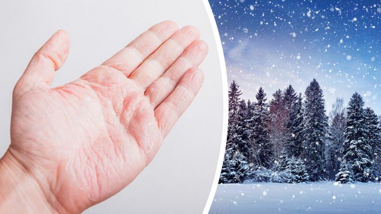 If You Have Dry Hands During Winter, Try This Overnight Trick