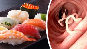 After Eating Sushi, You’ll Never Believe What Was Living In This Man’s Body