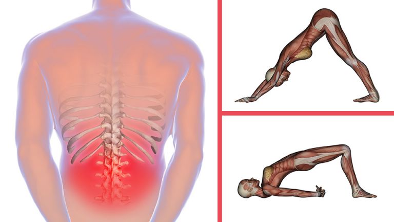 4 Ways To Soothe Your Own Sciatica Without Drugs