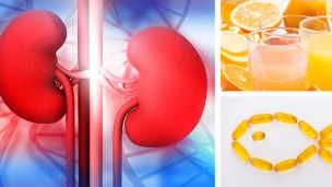 4 Ingredients That Will Flush Your Kidneys