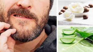 5 Natural Remedies For An Itchy Beard (Recipe Included)