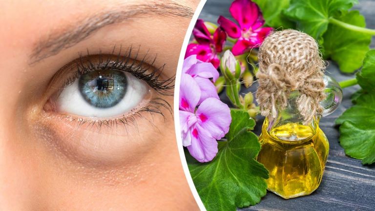 7 Essential Oils To Beat Puffy Eyes