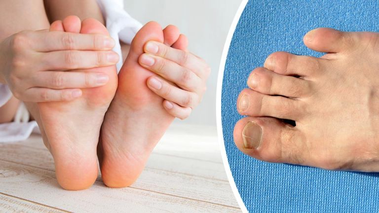 9 Things Your Feet Are Trying To Tell You About Your Health