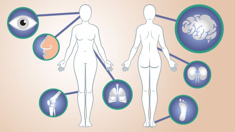 Ladies: 15 Early Warning Signs Of Lupus You Shouldn’t Ignore