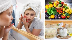 9 All-Natural Cures For Unsightly Large Pores