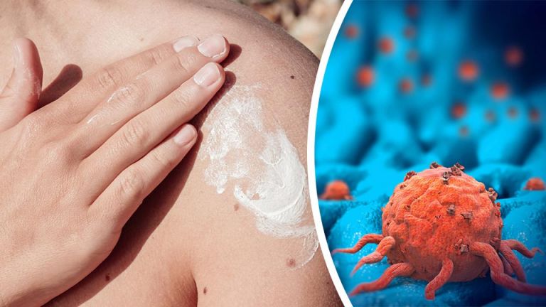 Is Your Sunscreen Increasing Your Risk Of Skin Cancer? Here’s Your Safest Choice