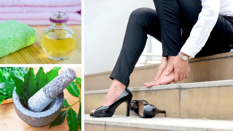 5 Natural Remedies For Cracked Heels