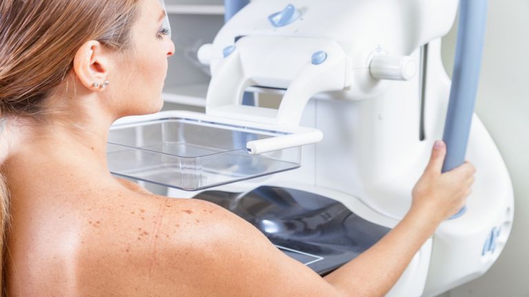 Is Mammography Outdated and Harmful? What You Can Do Instead