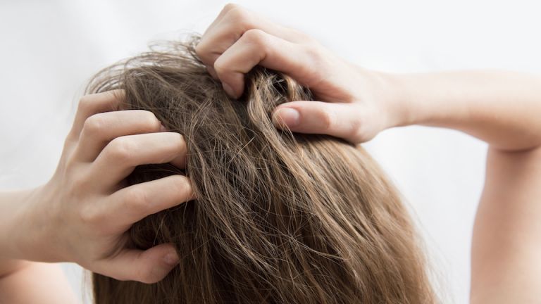 Here’s How to Fix an Itchy Scalp Once and For All