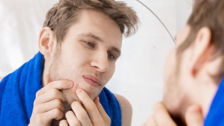 Why You Are a Pimple Popping Fanatic