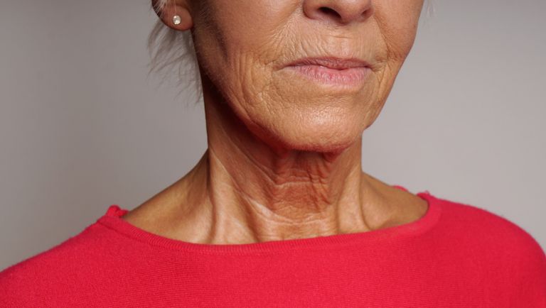 Turkey Neck Fixes That Really Work