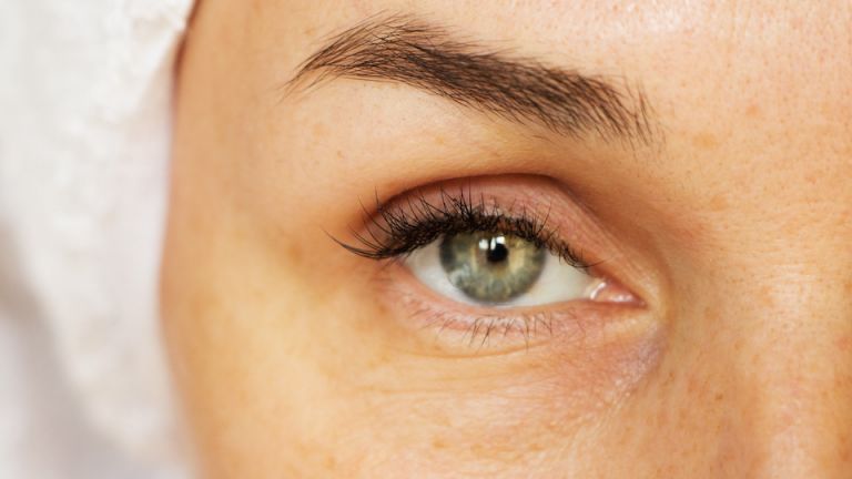 13 Cheap Tricks to Banish Dark Circles