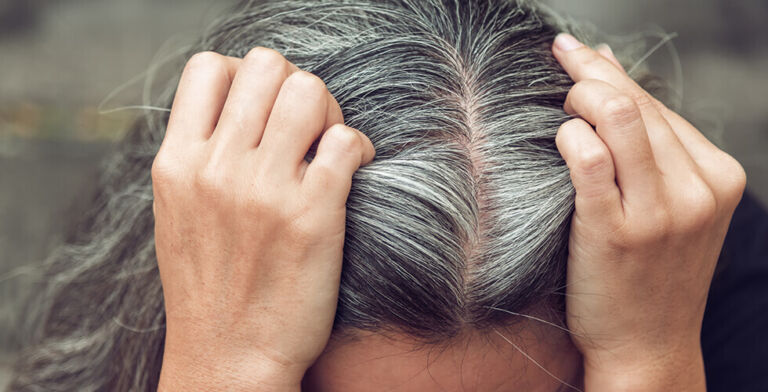 Fight Gray Hair Naturally with These Antioxidant-Rich Foods