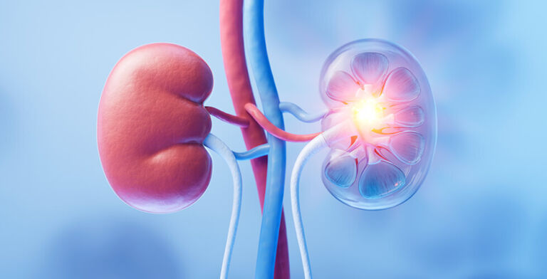 The Best Foods to Boost Kidney Health
