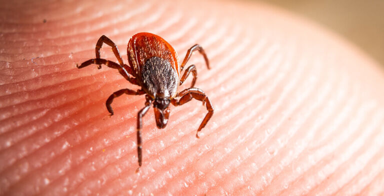 Three U.S. Tick Species May Trigger a Dangerous Red Meat Allergy—Here’s What You Need to Know