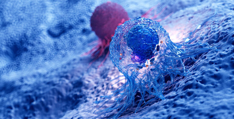 Up to Half of Cancer Deaths Linked to Lifestyle Choices, Study Finds