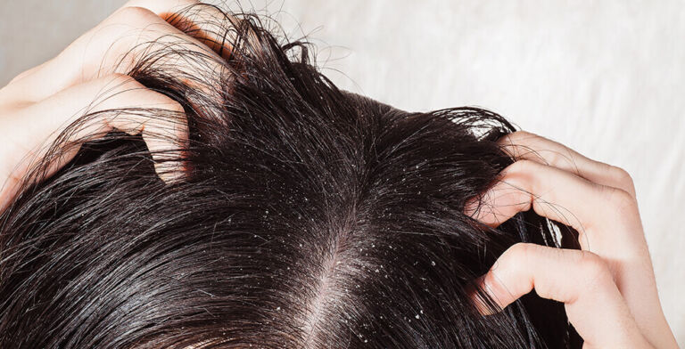 Why Your Head Itches and What to Do About It